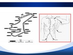 [SCC2012]逆向行驶：锁骨下动脉CTO病变介入治疗